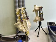 Уральская компания запустит импортозамещающее производство оборудования для операций на черепе